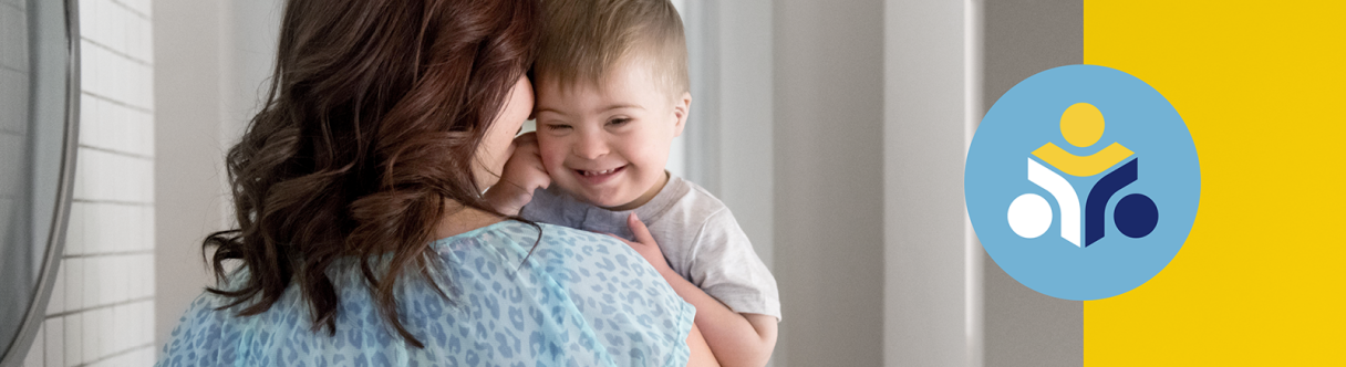 A woman holding a down syndrome baby